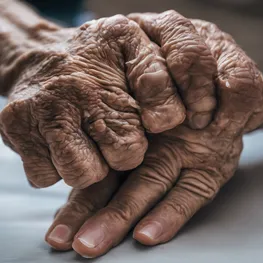 A close-up photograph of a person's hands, one showing the visible effects of diabetes-related joint health issues such as swelling, stiffness, or limited mobility, while the other hand appears healthy and unaffected.